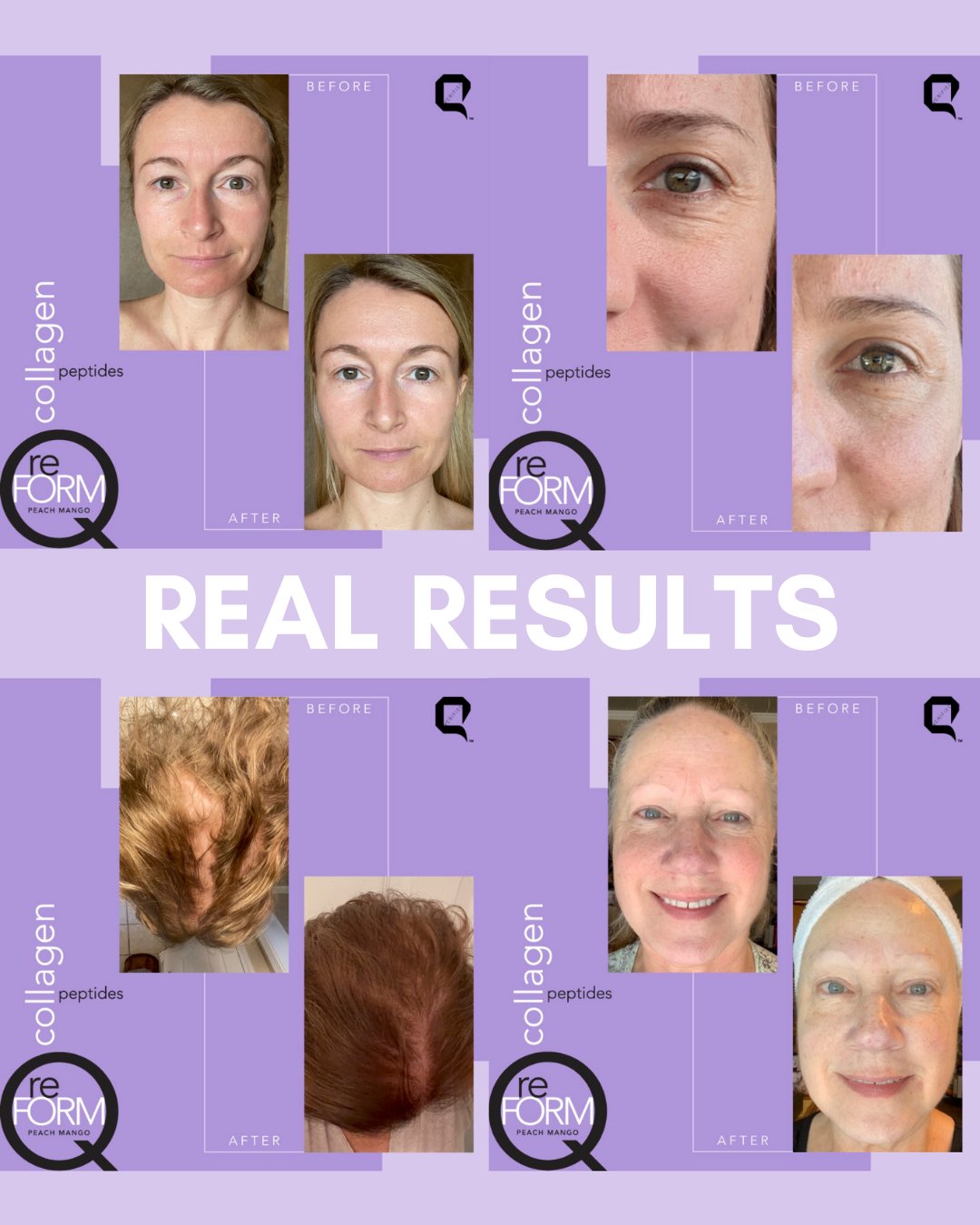 Q reFORM Collagen Peptides Single Servings